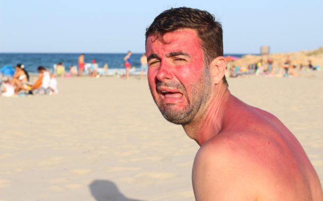 The 10 Most Common “Summer Fails” Include Sunburns, Sitting Around all Day, and Too Much Drinking